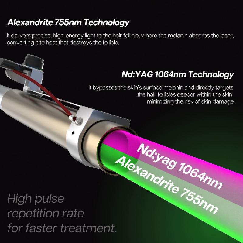 Máquina de Depilação a Laser N - Alexandrite Laser Hair Removal Machine avaliação e preço