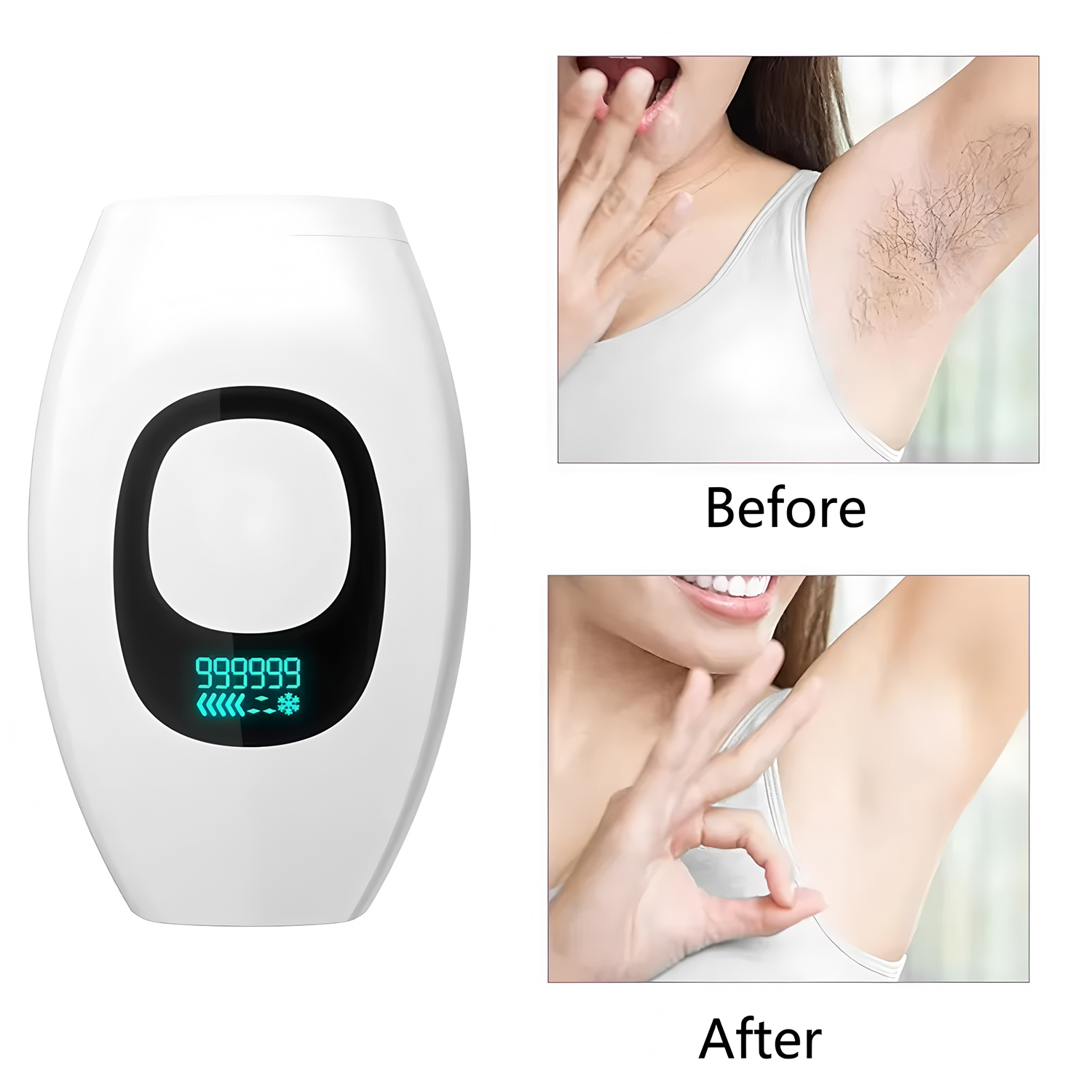 Depilador IPL com Display Digi - Ipl Hair Removal Handset Permanent avaliação e preço