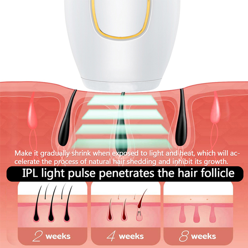 Depilador a laser permanente p - Ipl Hair Removal Handset Permanent avaliação e preço