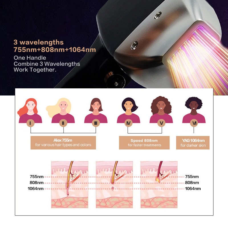 Máquina de Depilação a Laser d - Ice Titanium Diode Laser Machine avaliação e preço